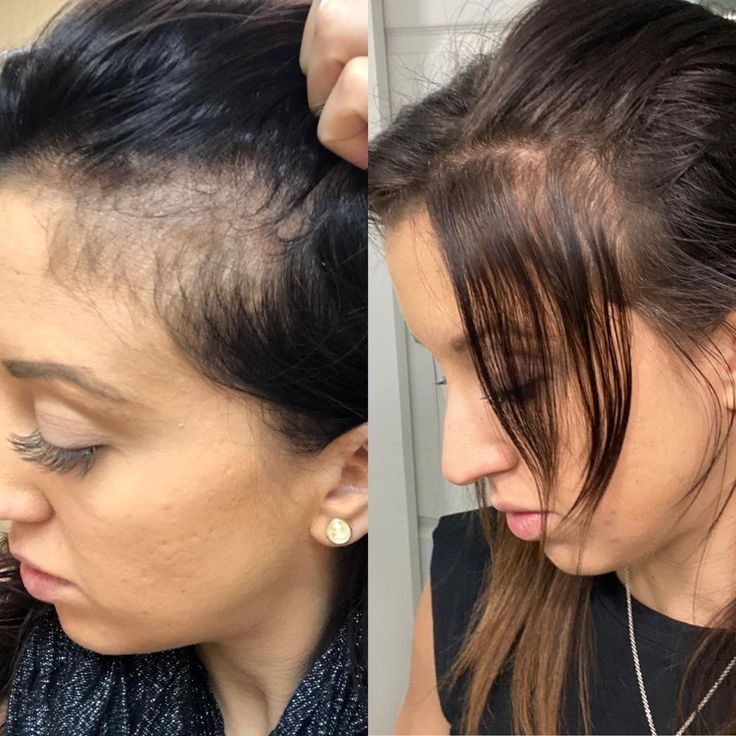 Antes y después · Andrea M.