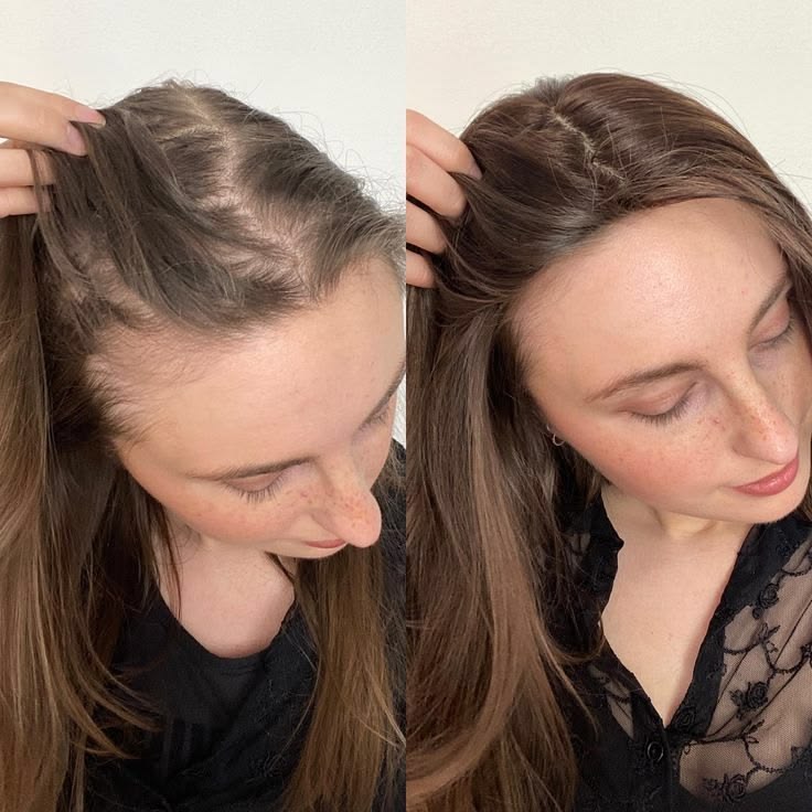 Antes y después · Mariana L.